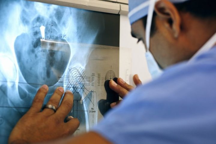 Here Are The Important Factors To Consider When Choosing An Orthopedic ...