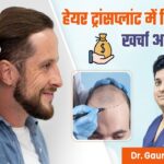 What are the Cost Factors of Hair Transplant in Delhi